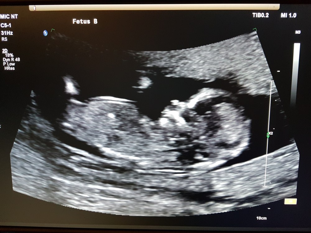 Broccoli 12 weeks.jpg